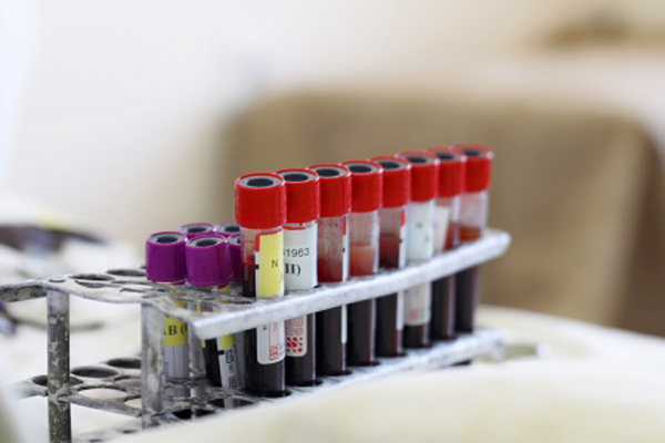 Сотрудники «Якутскэнерго» приняли участие в корпоративной донорской акции 