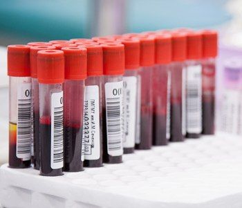 Азербайджанская молодежь провела в Москве акцию по сбору донорской крови