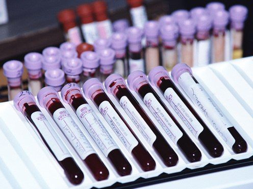 В Бурятии на «День донора» сдали кровь 66 человек