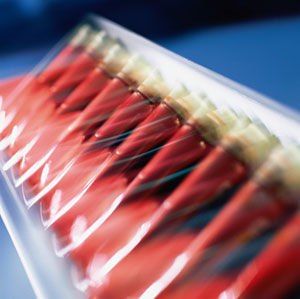 В Томске с нетерпением ждут новых доноров